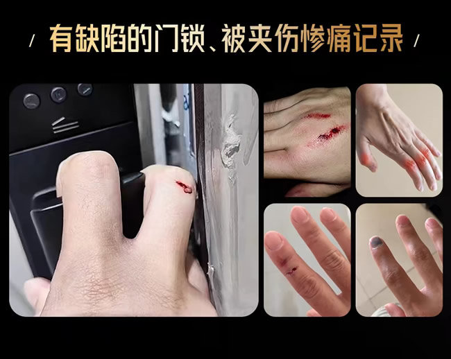 王力門業(yè) | 破大防！原來被門夾手是可以不用忍的！